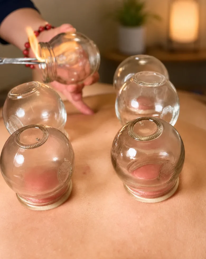 Cupping therapy treatment